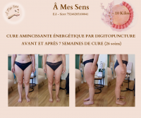 Avant et après 7 semaines de cure (26 soins)